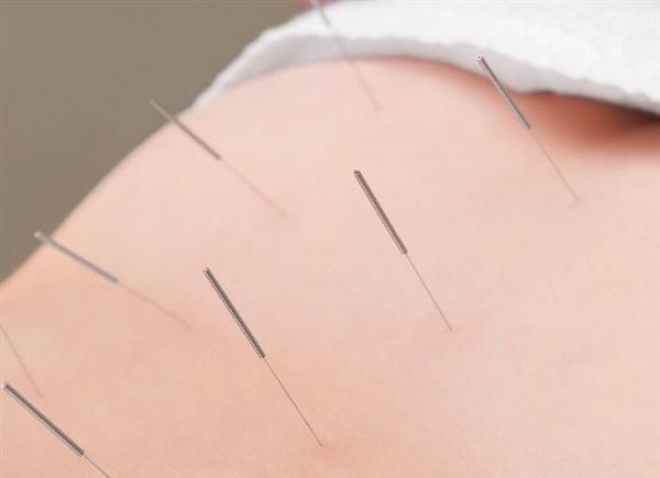 河北省郭氏按摩職業(yè)培訓(xùn)學(xué)校中醫(yī)針灸推拿專業(yè)培訓(xùn)班開課了嗎？