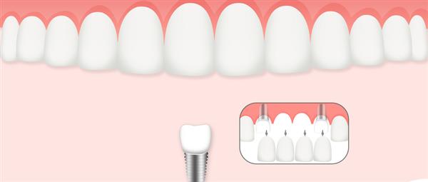 濟(jì)南口腔醫(yī)學(xué)專業(yè)學(xué)校是什么層次的學(xué)校？學(xué)校怎么樣？